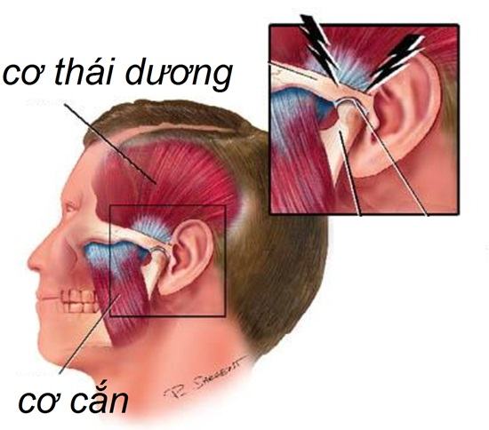 Cách điều trị viêm khớp thái dương hàm