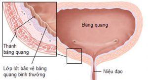 nuoc tieu co bot