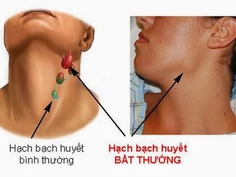 sung hach bach huyet