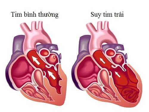 tim-dap-qua-nhanh