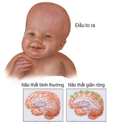 xet nghiem di tat
